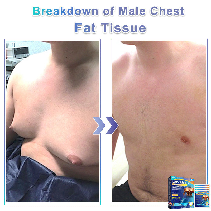 Chest Fatburn Patch