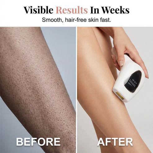 Painless Ipl Hair Removal Device